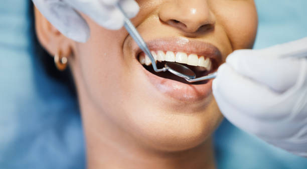Best Emergency Broken Tooth Repair in Exandria, AL